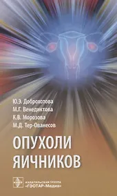 Купить Опухоли яичников — Фото №1