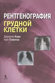 Купить Рентгенография грудной клетки — Фото №1