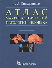 Купить Атлас макроскопической патологии человека: учебное пособие — Фото №1
