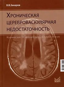 Купить Хроническая цереброваскулярная недостаточность — Фото №1