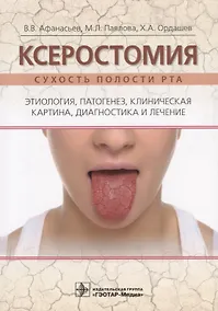 Купить Ксеростомия. Сухость полости рта. Этиология, патогенез, клиническая картина, диагностика и лечение — Фото №1