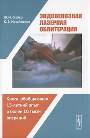 Купить Эндовенозная лазерная облитерация — Фото №1