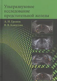 Купить Ультразвуковое исследование предстательной железы. Учебное пособие — Фото №1
