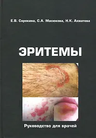 Купить Эритемы. Руководство для врачей — Фото №1