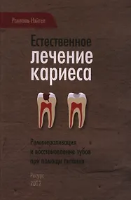 Купить Естественное лечение кариеса. Реминерализация и восстановление зубов при помощи питания — Фото №1