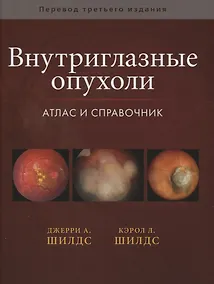 Купить Внутриглазные опухоли. Атлас и справочник — Фото №1