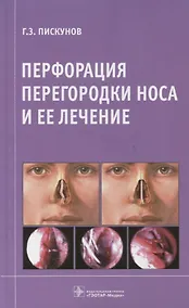 Купить Перфорация перегородки носа и ее лечение. — Фото №1