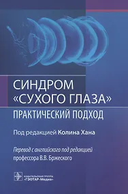 Купить Синдром "сухого глаза". Практический подход — Фото №1