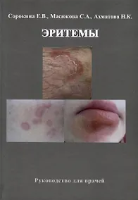 Купить Эритемы. Руководство для врачей — Фото №1