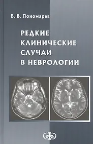 Купить Редкие клинические случаи в неврологии. Руководство для врачей — Фото №1
