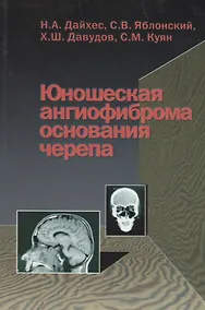 Купить Юношеская ангиофиброма основания черепа — Фото №1