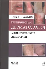Купить Клиническая дерматология. Аллергические дерматозы. — Фото №1