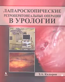 Купить Лапароскопические ретроперитонеальные операции в урологии — Фото №1