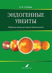 Купить Эндогенные увеиты — Фото №1