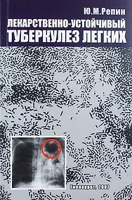 Купить Лекарственно-устойчивый  туберкулез легких: хирургическое лечение — Фото №1