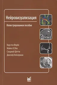 Купить Нейровизуализация — Фото №1