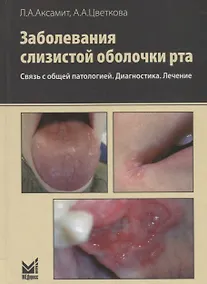 Купить Заболевания слизистой оболочки рта. Связь с общей патологией. Диагностика. Лечение. 2-е изд. — Фото №1