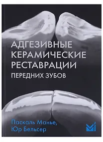 Купить Адгезивные керамические реставрации передних зубов — Фото №1