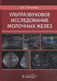 Купить Ультразвуковое исследование молочных желез — Фото №1