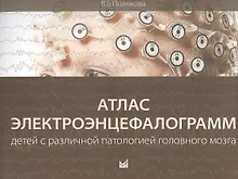 Купить Атлас электроэнцефалограмм детей с различной патологией головного мозга — Фото №1