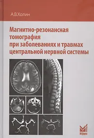 Купить Магнитно-резонансная томография при заболеваниях и травмах центральной нервной системы — Фото №1