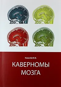Купить Каверномы мозга — Фото №1