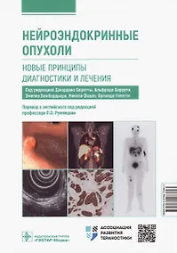 Купить Нейроэндокринные опухоли. Новые принципы диагностики и лечения. Руководство для врачей — Фото №1