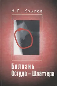Купить Болезнь Осгуда - Шлаттера — Фото №1