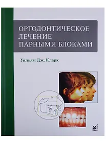 Купить Ортодонтическое лечение парными блоками — Фото №1
