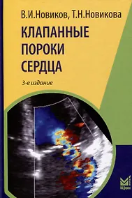 Купить Клапанные пороки сердца — Фото №1