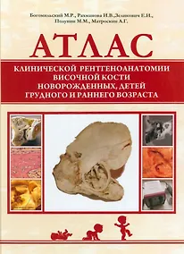 Купить Атлас клинической рентгеноанатомии височной кости новорожденных, детей грудного и раннего возраста — Фото №1
