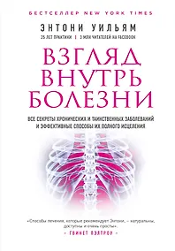 Купить Взгляд внутрь болезни. Все секреты хронических и таинственных заболеваний и эффективные способы их полного исцеления (2-е издание) — Фото №1