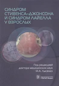 Купить Синдром Стивенса–Джонсона и синдром Лайелла у взрослых — Фото №1