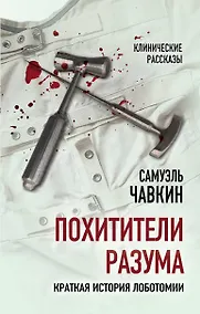 Купить Похитители разума. Краткая история лоботомии — Фото №1