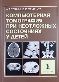 Купить Компьютерная томография при неотложных состояниях у детей — Фото №1
