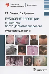 Купить Рубцовые алопеции в практике врача-дерматовенеролога. Руководство для врачей — Фото №1