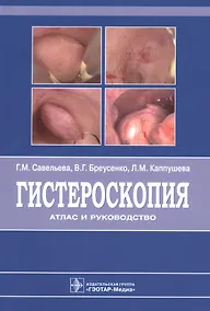 Купить Гистероскопия : атлас и руководство. 2-е издание, дополненное и переработанное — Фото №1