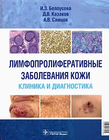 Купить Лимфопролиферативные заболевания кожи. Клиника и диагностика — Фото №1