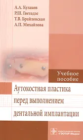 Купить Аутокостная пластика перед выполнением дентальной имплантации. — Фото №1