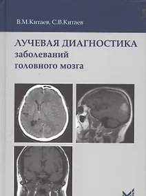 Купить Лучевая диагностика заболеваний головного мозга — Фото №1