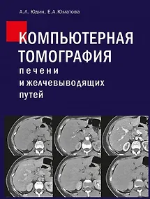 Купить Компьютерная томография печени и желчевыводящих путей: практическое руководство. — Фото №1