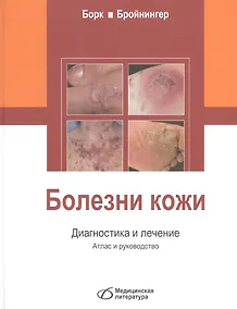 Купить Болезни кожи. Диагностика и лечение — Фото №1