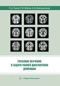 Купить Глубокое обучение в задаче ранней диагностики деменции — Фото №1