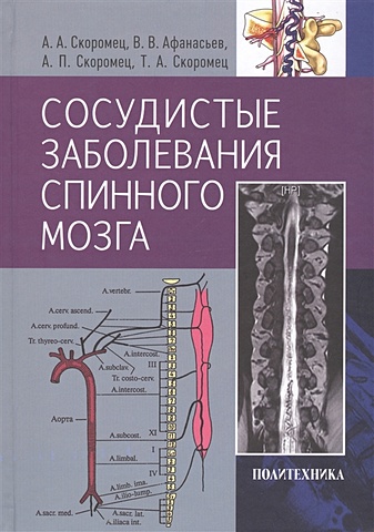 Скоромец А., Афанасьев В., Скоромец А., Скоромец Т. Сосудистые заболевания спинного мозга. Руководство для врачей