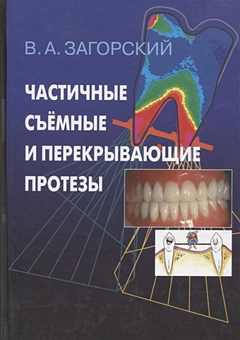 Частичные съемные и перекрывающие протезы. Морфология и ультраструктура муслов с арутюнов с механические свойства зуба и околозубных тканей монография