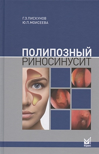 Пискунов Г., Моисеева Ю. Полипозный риносинусит полипозный риносинусит 2 е издание дополненное пискунов г з
