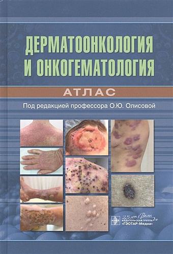 Олисова О. (ред.) Дерматоонкология и онкогематология. Атлас