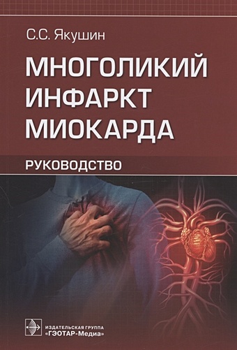 Якушин С. Многоликий инфаркт миокарда: руководство сыркин а л инфаркт миокарда