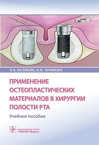 Базикян Э., Чунихин А. Применение остеопластических материалов в хирургии полости рта. Учебное пособие