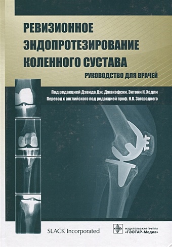 Джакофски Д., Хэдли Э. (ред.) Ревизионное эндопротезирование коленного сустава. Руководство для врачей